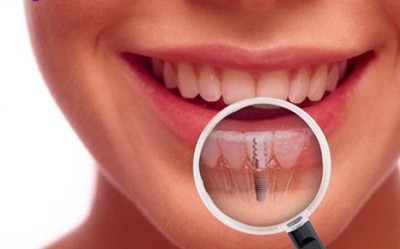 معیارهای یک درمان موفق در دندانپزشکی