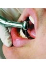 پنج نکته درباره پروتز دندان