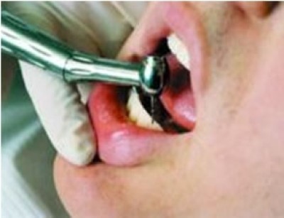 پنج نکته درباره پروتز دندان