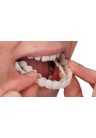 «کاور دندان»، درمان موقت برای زیبایی لبخند