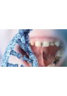  نفی ارتباط ژنتیک و پوسیدگی دندان
