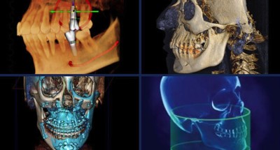  تکنولوژی‌ها و نرم‌افزارهای جدید در حوزه ایمپلنتولوژی