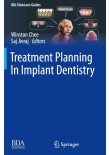 Treatment Planning In Implant Dentistry 2024