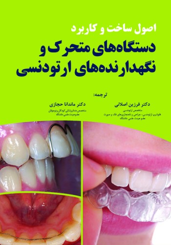 اصول ساخت و کاربرد دستگاه‏ های متحرک و نگهدارنده های ارتودنسی
