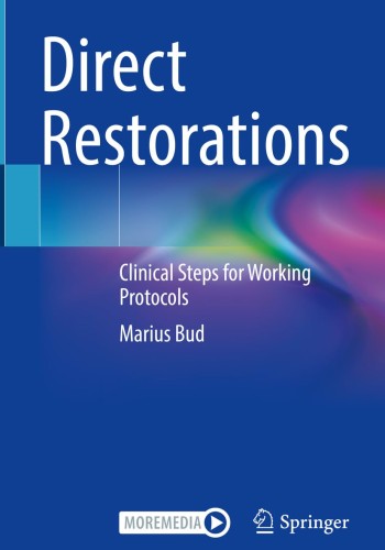 Direct Restorations: Clinical Steps for Working Protocols 2024