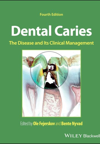 Dental Caries: The Disease and its Clinical Management 2025