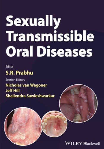 Sexually Transmissible Oral Diseases 2023