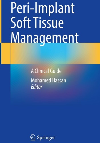 Peri-Implant Soft Tissue Management 2024
