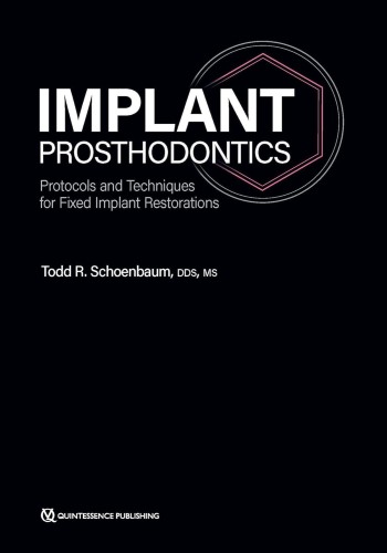 Implant Prosthodontics: Protocols and Techniques for Fixed Implant Restorations 2022
