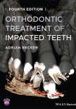 Orthodontic Treatment of Impacted Teeth 2022