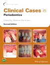 1119583950(-) Clinical Cases in Periodontics  2nd Edition by Nadeem Karimbux Wiley 2022-1.jpg