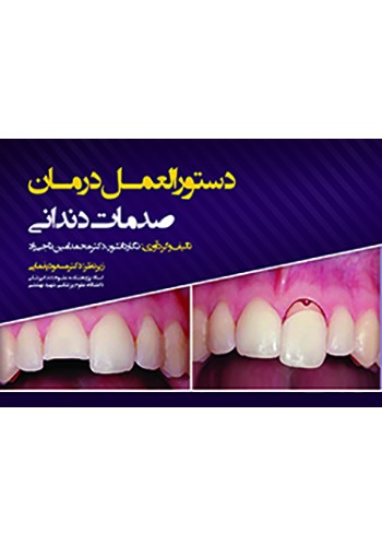 دستورالعمل درمان صدمات دندانی