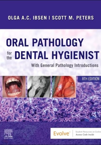 Oral Pathology for the Dental Hygienist 2022