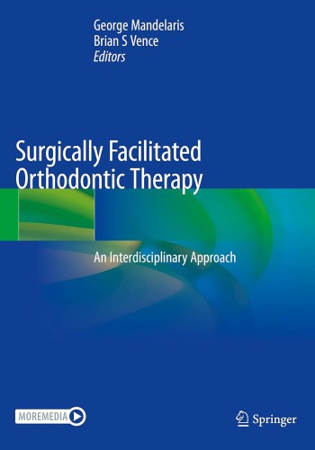 Surgically Facilitated Orthodontic Therapy: An Interdisciplinary Approach 2023