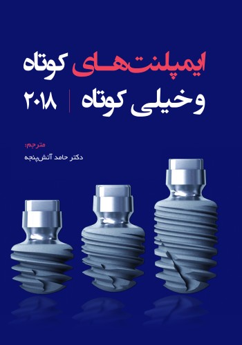 ایمپلنت‌های کوتاه و خیلی کوتاه
