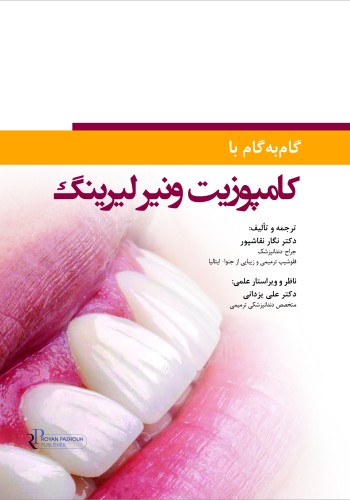 گام به گام با کامپوزیت ونیر لیرینگ