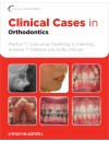 144-Clinical Cases in Orthodontics (2012)-1.jpg
