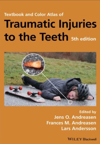 textbook&Color Atlas of Traumatic Injuries to the Teeth (andreasen) 2019