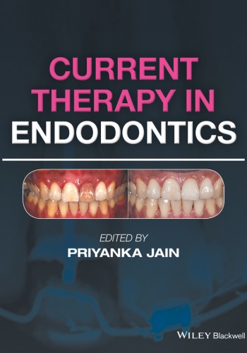 Current Therapy in Endodontics 2016