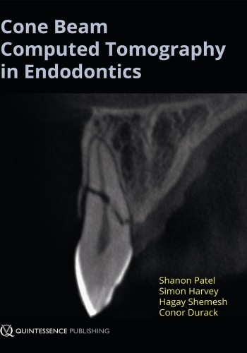 Cone-Beam-Computed-Tomography in Endodontics2016