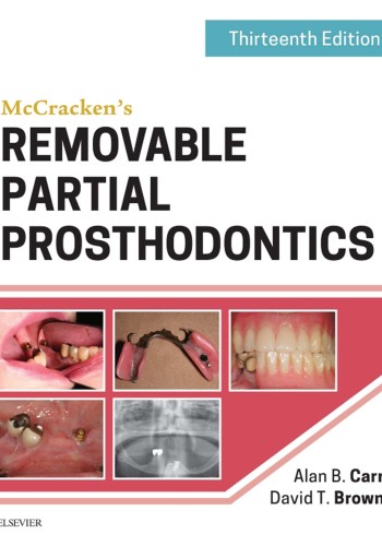 McCracken's Removable Partial Prosthodontics 2016