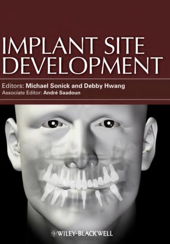 Implant Site  Development2012