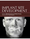 172-RP-Implant Site Development (2012)-1.jpg