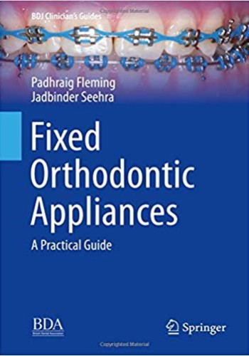 Fixed Orthodontic Appliances 2019