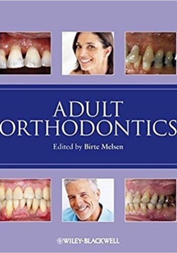 Adult Orthodontics 2012