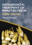 Orthodontic Treatment of  Impacted Teeth 2012