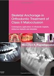 Skeletal Anchorage in Orthodontic Treatment of Class II Malocclusion 2015