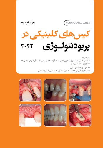 کیس های کلینیکی در پریودنتولوژی 2022