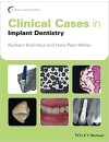206-RP-Clinical Cases in Implant Dentistry (2017).jpg