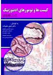 کیست ها و تومورهای ادونتوژنیک (Gnepp 2009)
