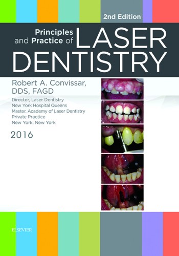 Principles and Practice of LASER DENTISTRY 2016