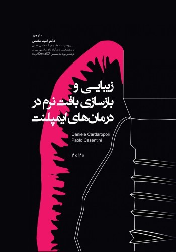 زیبایی و بازسازی بافت نرم در درمان های ایمپلنت 2020 کاغذ تحریر