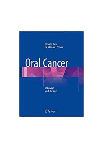 Oral Cancer 