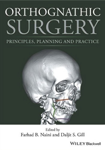 Orthognathic Surgery: Principles, Planning and Practice 2017