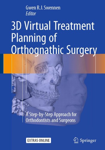 3D Virtual Treatment Planning of Orthognathic Surgery 2017 