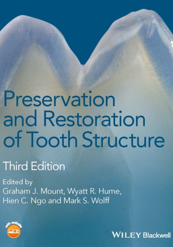 Preservation and Restoration of Tooth Structure 2016