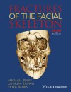 236-RP-Fractures of the Facial Skeleton (2015).jpg