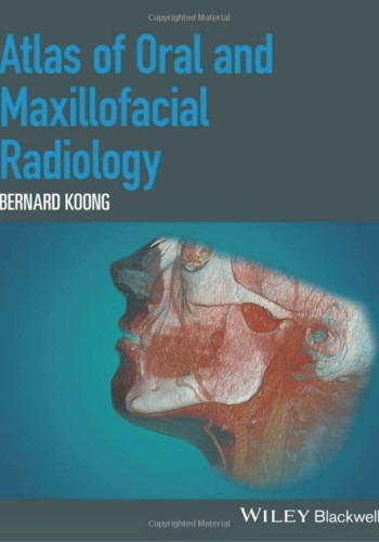 Atlas of Oral and Maxillofacial Radiology 2017