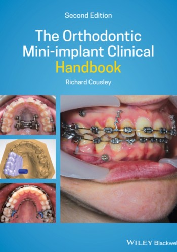 The Orthodontic Mini-implant Clinical Handbook 2020