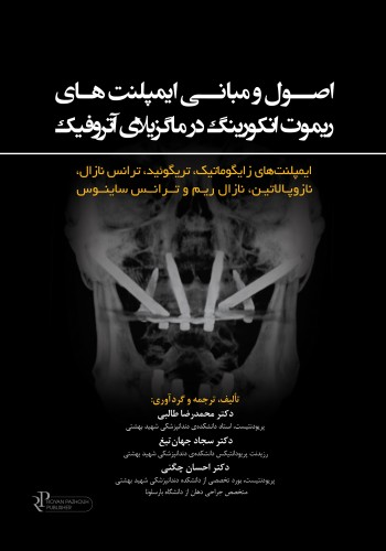 اصول و مبانی ایمپلنت های ریموت انکورینگ در ماگزیلا ی آتروفیک