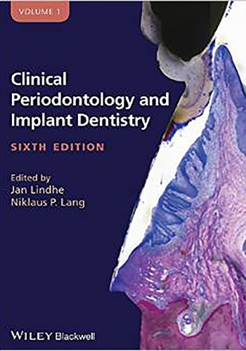 Clinical Periodontology and Implant Dentistry(Lindhe) 2015 - VOL 1 & 2