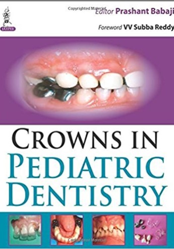 CROWNS IN PEDIATRIC DENTISTRY 2015