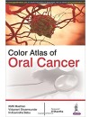 279-RP-Color Atlas of Oral Cancer (2016).jpg
