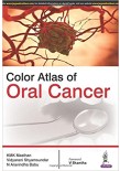 Color Atlas of Oral Cancer