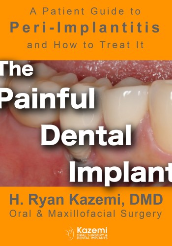  The Painful Dental Implant