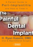  The Painful Dental Implant